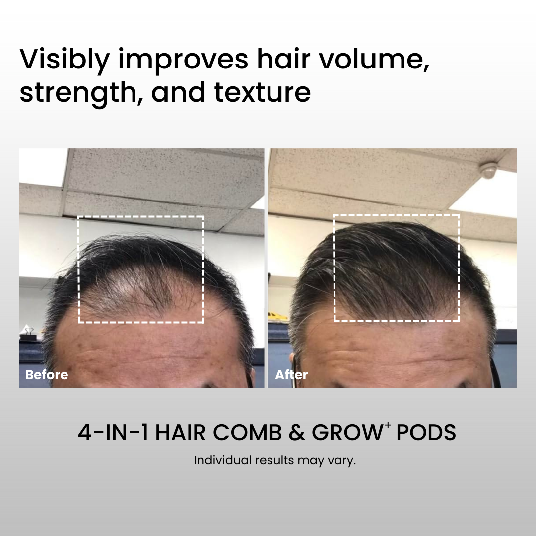 Before and after comparison of hair volume using a 4-in-1 hair comb and grow pods.