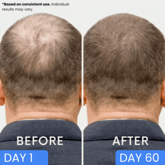 Dual-Applicator Hair Regrowth System